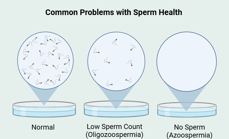 Azoospermia-illustration-AFIC
