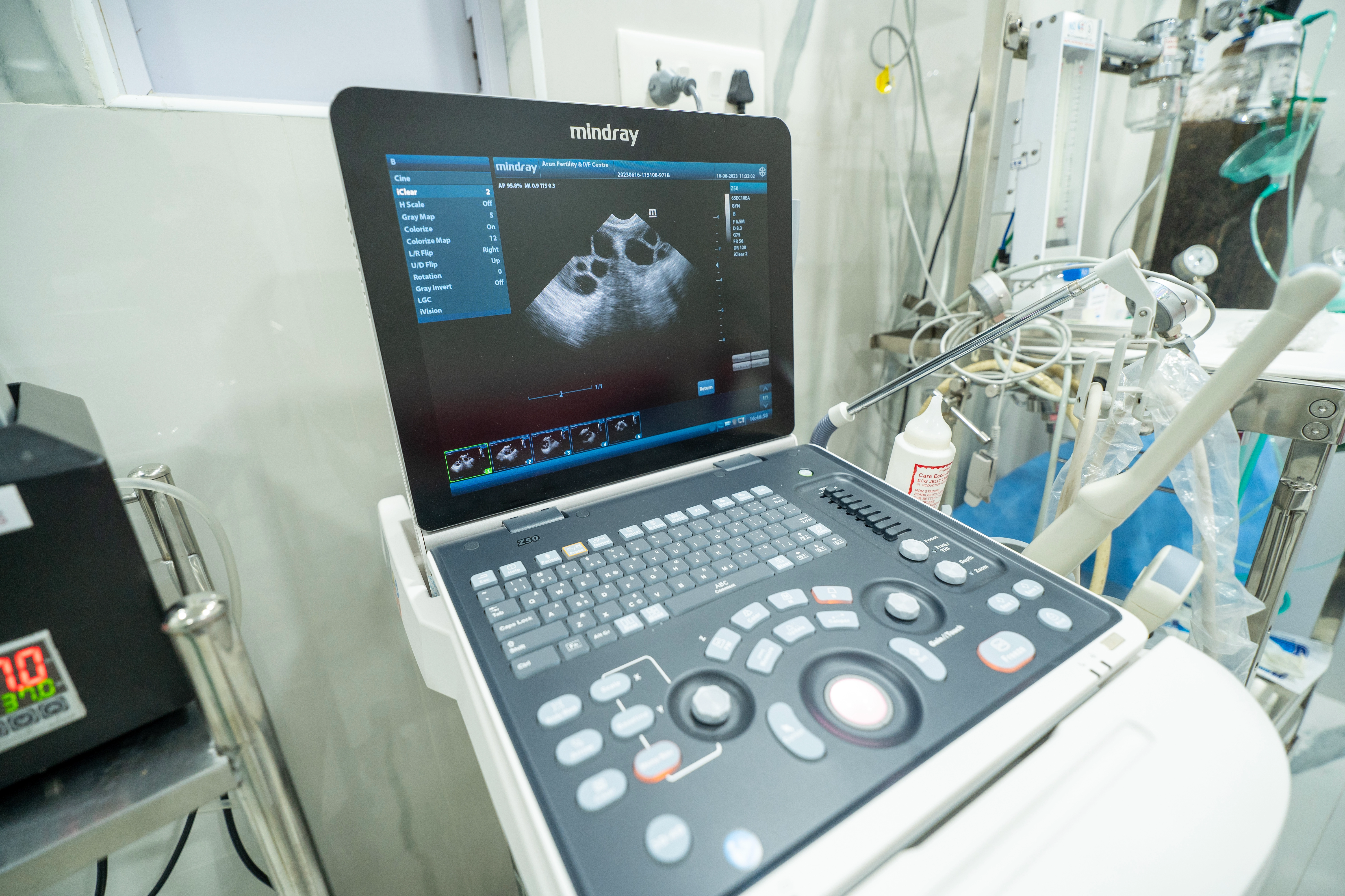 High-tech Ultrasound device